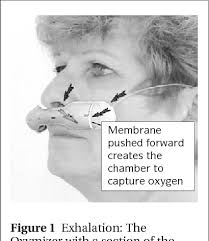Gentle suction as required to keep nares clear. Pdf Using A Reservoir Nasal Cannula In Acute Care Semantic Scholar