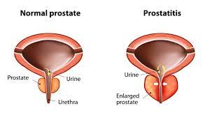 However, as with other types of cancer,. Prostate Enlargement In Dogs Petcoach