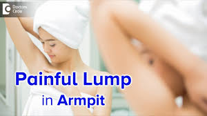 Painful Armpit Lump Causes Diagnosis And Treatment Dr Nanda Rajaneesh Doctors Circle Youtube