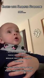 Sandifer syndrome is a condition characterized by unusual movements of your  child’s head, neck and back. The condition can cause temporary muscle  spasms as a reaction to acid reflux. Symptoms are most ...