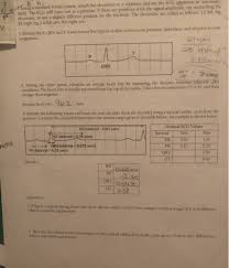 And Use The Ecg Apparatus In Automatsc 8 A Using A