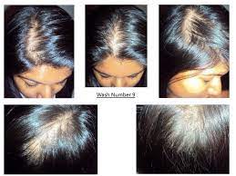 You might see the products in nioxin in many salons and salon supply stores. Nioxin Nioxin Hair System Kit 2 Noticeably Thinning Hair Review Beauty Bulletin Treatments Masks