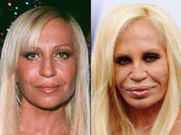 Wayne newton plastic surgery is one of those that can be noticed in a single gaze. 22 Celebrities Before After Plastic Surgery Gallery