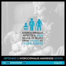 Pin On Hydrocephalus