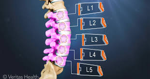 Hi my name is xxxxx l am 59yrs old and was recently diagnosed with reversal of the lord is.dextroscoliosis in the mid upper thoracic spine , stenosis and osteophyte formation near my spinal cord. Lumbar Spine Definition Back Pain And Neck Pain Medical Glossary