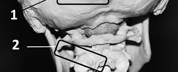 Occipital Nerve Block Dna Advanced Pain Treatment Center