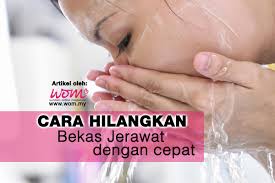 Cara Menghilangkan Bekas Jerawat Dengan Cepat Women Online Magazine