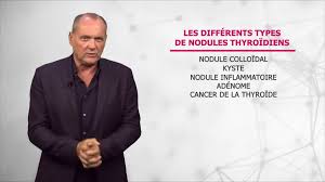 Symptômes chez la femme, conséquences possibles et pronostic de la maladie. Nodule Thyroidien Causes Symptomes Et Ponction