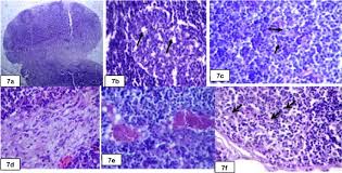 If you have a particular area of swelling, you can apply. Lymph Node Histopathological Studies In A Combined Adjuvant Collagen Induced Arthritis Model In Albino Rat Rattus Rattus Sciencedirect