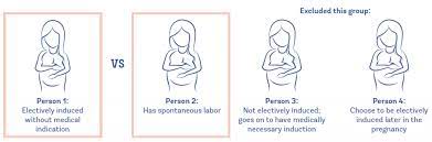 Evidence On Inducing For Due Dates Evidence Based Birth