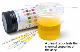 If a urine culture is required, a separate (new) specimen must be collected. Urinalysis Vca Animal Hospital