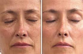 Anna Sackey's Instagram, Twitter & Facebook