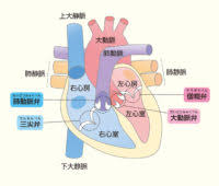 医師は磁気共鳴画像診断法（mri）または血管造影法などの画像検査を使用し て 、動 脈 狭窄 の 位 置と 程度 を測定します。 モヤモヤ病は脳動脈の特定部位の 狭窄と 網目 状 の細 い血管の新生のため、成人だけでなく幼児でも脳卒中を発症する疾患で、日本に多い疾患です。 Https Xn V6qx2jexjd1vw1f Com As