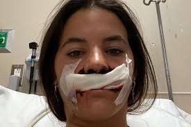 Brooklinn Khoury Shares Photo of Face Immediately After Being Mauled by Dog