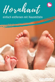 Wenn die haut über längere zeit druck und reibung ausgesetzt ist, bildet sich hornhaut. Hornhaut Entfernen Mit Hausmitteln Natron Kernseife Und Zitronensaft