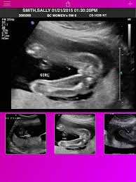 Try these smart fake gps location apps. Ultrasound Prank Free Pregnant Spoof And Fake Pregnancy Trick App For Iphone Free Download Ultrasound Prank Free Pregnant Spoof And Fake Pregnancy Trick For Ipad Iphone At Apppure