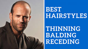 As you age, minor hair loss around your temples is normal and that's why these 100+ hairstyles for men with receding hairlines will help you! Choosing Best Men S Hairstyle For Thinning Balding Hair Receding Hair Line Ashley Weston