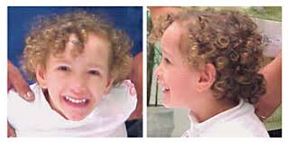 Typical Sotos facial gestalt of patient 4 at the age of three years.