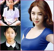 Yoo In Na Plastic Surgery Korean Plastic Surgery Top Shocking Idol Plastic Surgery Before And After Plast Korean Plastic Surgery Plastic Surgery Surgery