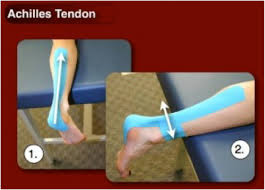 Image result for Taping for Soleus and Achilles