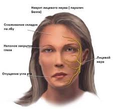 Pochemu Mozhet Nemet Golova Chastye Prichiny Diagnostika I Lechenie