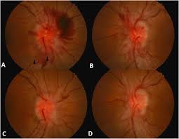 Image result for Pseudoeriosema