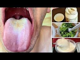 Youtube Oral Care Routine Natural Toothpaste Yeast Infection Home Remedy
