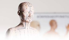 Acupuncture (insertion of needles for remedial purposes). Akupunktur In Der Orthopadie Sportopaedie Heidelberg
