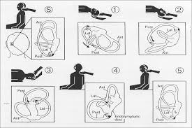 The epley maneuver, named after dr. Epley Maneuver Recording Alan Desmond