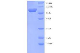 Methylthiopropylamine, a potent inhibitor of spermidine synthase and its antiproliferative effect on human lymphoid leukemia molt 4b cells 2. Human Spermidine Synthase Srm Protein Gst Tag Recombinant Abin618738