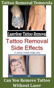 Tattoos Removal How To Numb Skin Before Tattoo Removal How Can You Remove A Tattoo How To Remove A Te Tattoo Removal Cost Tattoo Removal Eyebrow Tattoo Removal