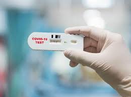 Perché effettuare il test rapido. Coronavirus Anvisa Aprova Teste Rapido De Empresa Italiana 03 06 2020 Uol Vivabem