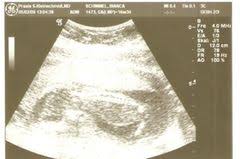 Dadurch nimmst du ebenfalls weiter an gewicht zu und der die kindsbewegungen sind durch die steigende größe und aktivität des babys täglich zu spüren. 24 Schwangerschaftswoche 24 Ssw Alle Infos Eltern De