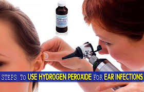 Commercially available ear cleansing solutions treating the ears with hydrogen peroxide to clean dog ears, common household items such as vinegar and hydrogen peroxide can be. Ears How To Clean With Hydrogen Peroxide Cleaning Tips