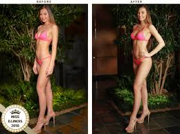 This metric can vary depending on your surgery and your unique needs, and many costs are not included in this number. Breast Enlargement Chicago Breast Augmentation Dr Turowski Plastic Surgery Chicago
