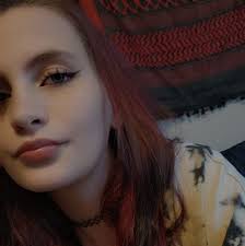 Gastroparesis diagnosis after feeding tube placement?