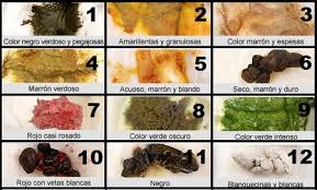 Identificar El Porque Del Color Del Popo Del Bebe Bebes De Mayo 2014 5 Anos Pagina 3 Babycenter