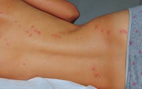 pin on get rid of insects in home