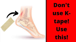 Image result for Taping for Soleus and Achilles