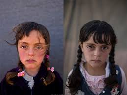 Armut, vermüllte meere und kinderarbeit. Unicef Deutschland En Twitter Zwei Fotos Ein Blick Fotograf Muheisen81 Hat Das Syrische Madchen Zahra Vom Unicef Foto Des Jahres Wiedergetroffen Wie Geht Es Ihr Heute Wovon Traumt Sie Https T Co Lek7uonf50 Zahra Jordanien Fotodesjahres