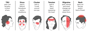 Trigger Point Therapy Treating Tension Headaches Part 3