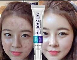 Ka bialnu skincare va be teh ang 😑🥱🥱