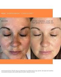 I know many may never have ever seen any of the Kentucky Derby's but an  incredible horse teaches us a valuable life lesson this past weekend!  🐎🌹❤️ His story is your story….