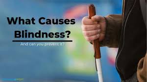 The topic of color blindness is fascinating because of its color blindness is often inherited, but may also occur because of eye, nerve, or brain damage, or from exposure to certain chemicals. What Causes Blindness And Can We Prevent It Everyday Sight