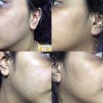 Nykaa SKINRX Spot Corrector with 10% Niacinamide + 1% Zinc Serum to Fade  Dark Spots & Pigmentation Reviews