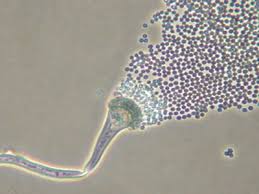 Carpet water damage mold and black mold in carpet can develop anytime your carpet has become wet and stayed wet for a while without the opportunity to dry out thoroughly. Carpet Mold Identification Prevention And Removal Internachi