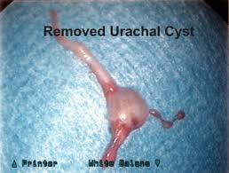 Image result for Umbilicus botryoides