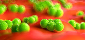Check spelling or type a new query. Mrsa Symptome Typische Anzeichen Einer Infektion Erkennen Was Tun