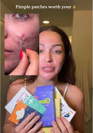 + videos of how each patch works!! Pimple patches are my best friend when a  cystic pimple pops up