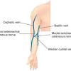 Flashcards in anatomical names deck (42). 1